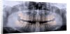 Panoramic X-Ray of Mouth by Anonymous