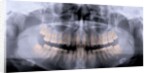 Panoramic X-Ray of Mouth by Anonymous