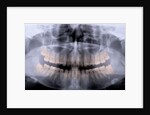Panoramic X-Ray of Mouth by Anonymous