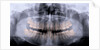 Panoramic X-Ray of Mouth by Anonymous