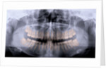 Panoramic X-Ray of Mouth by Anonymous