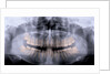 Panoramic X-Ray of Mouth by Anonymous