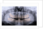 Panoramic X-Ray of Mouth by Anonymous