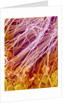 Sperm in Testis of a Rat by Anonymous