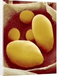 Starch Grains of Potato Cells by Anonymous