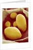 Starch Grains of Potato Cells by Anonymous