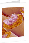 Sperm in Testis of a Rat by Anonymous