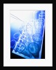 Test Tubes in Tray by Anonymous