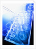 Test Tubes in Tray by Anonymous