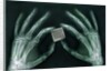 Skeletal Hands Holding Barcode by Anonymous