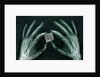 Skeletal Hands Holding Barcode by Anonymous