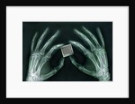 Skeletal Hands Holding Barcode by Anonymous