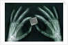 Skeletal Hands Holding Barcode by Anonymous