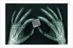 Skeletal Hands Holding Barcode by Anonymous
