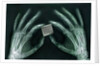 Skeletal Hands Holding Barcode by Anonymous