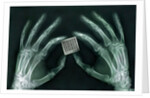 Skeletal Hands Holding Barcode by Anonymous