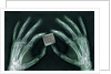 Skeletal Hands Holding Barcode by Anonymous