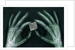 Skeletal Hands Holding Barcode by Anonymous