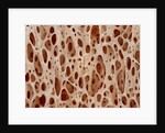 Bone tissue of a hen magnified x25 by Anonymous