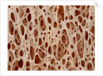 Bone tissue of a hen magnified x25 by Anonymous