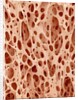 Bone tissue of a hen magnified x25 by Anonymous