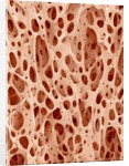 Bone tissue of a hen magnified x25 by Anonymous