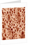 Bone tissue of a hen magnified x25 by Anonymous
