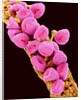 Geranium pollen at a magnification of x300 by Anonymous