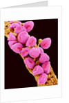 Geranium pollen at a magnification of x300 by Anonymous