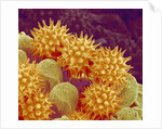 Sunflower pollen at a magnification of x1000 by Anonymous