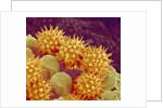 Sunflower pollen at a magnification of x1000 by Anonymous