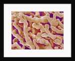 Human Placenta by Anonymous