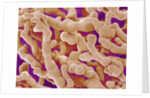 Human Placenta by Anonymous