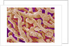 Human Placenta by Anonymous