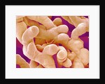 Human Placenta by Anonymous