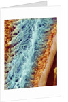 Sperm in rat testes by Anonymous