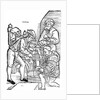 Amputation of leg without anaesthetic by Anonymous