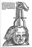 Trepanation by Anonymous