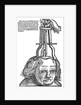 Trepanation by Anonymous