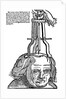 Trepanation by Anonymous