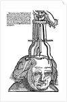 Trepanation by Anonymous