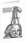 Trepanation by Anonymous