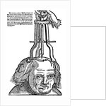 Trepanation by Anonymous