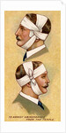 Man with bandaged head by Anonymous