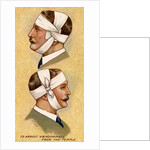 Man with bandaged head by Anonymous