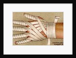 Bandaged hand by Anonymous