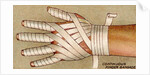 Bandaged hand by Anonymous