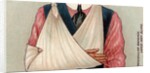 Arm in sling by Anonymous