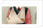 Arm in sling by Anonymous