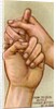 Bleeding finger by Anonymous